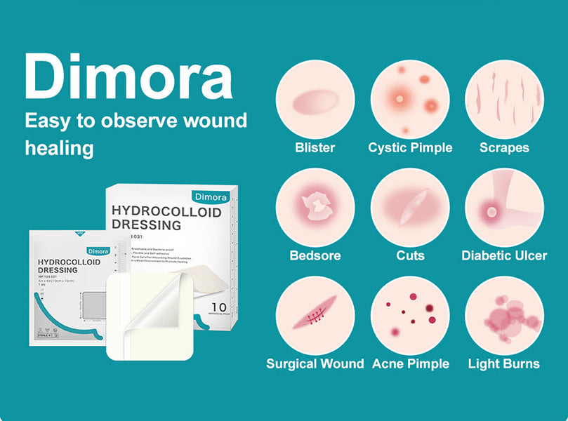 Hydrocolloid Bandages Use Body Heat to Speed Wound Healing